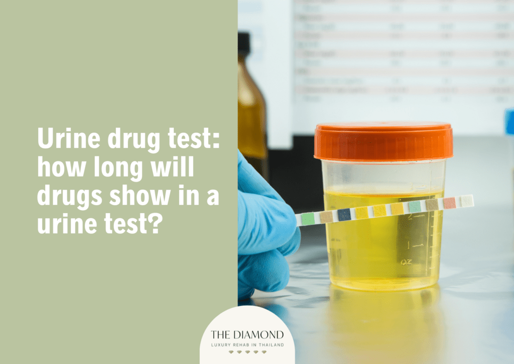 Urine drug test: how long will drugs show in a urine test
